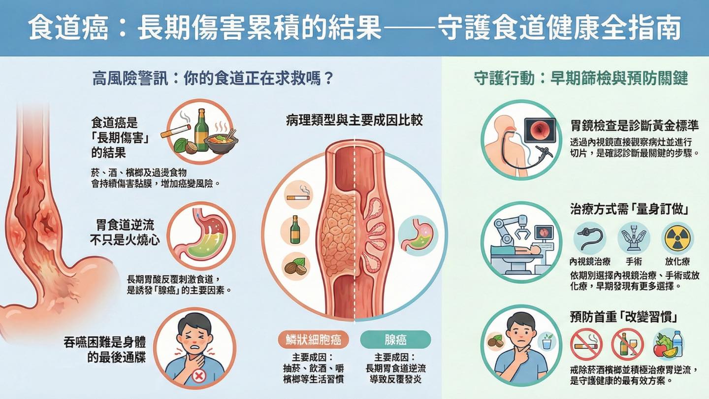 什麼是食道癌